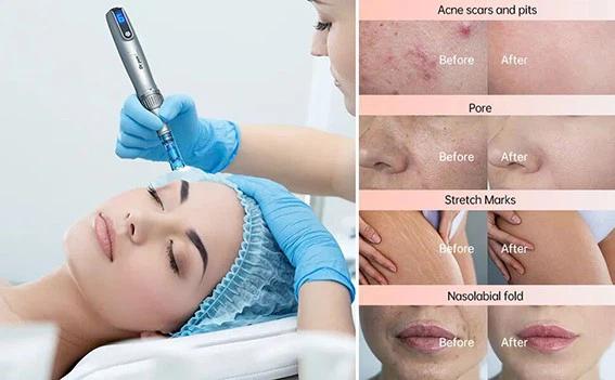 product-567-351 product-567-351